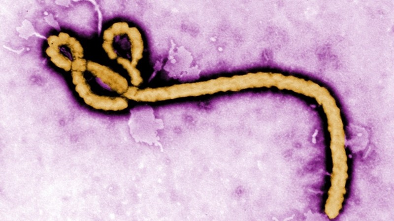  First Caribbean National, A Doctor, Tests Positive for Ebola